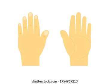 Flaches Stilsymbol. Handsatz Vorderseite und Rückseite. Vektorgrafik Rechts, linke Handfläche Keine Gesten einzeln auf weißem Hintergrund.
Design-Element.
