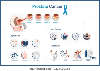 Flat vector concept Medical infographic illustration of prostate cancer.states of prostate cancer,symptoms,risk factors and diagnosis of prostate cancers.isolated on white background.