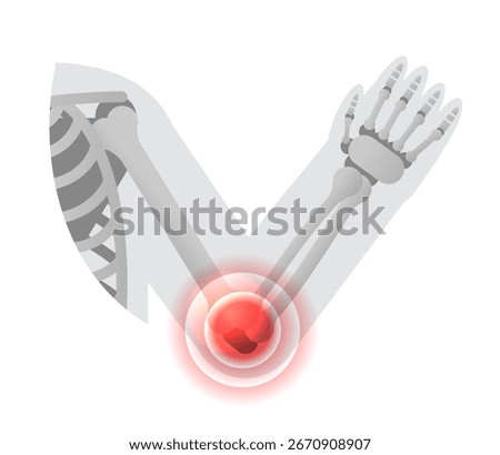 Flat vector elbow joint pain. Clinic treatment vector icon 