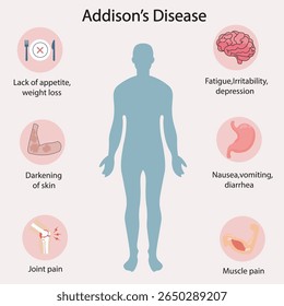 Flache Vektorgrafik der Addison-Krankheit, die Symptome wie Müdigkeit, dunkle Haut, Depression, Übelkeit, Gelenkschmerzen zeigt. Ähnlich wie Nebenniereninsuffizienz und Hypothyreose.