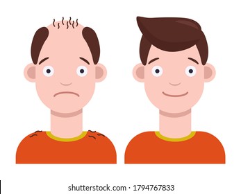 Flat Vector Illustration: Man With Bald Head And Man With Thick Hair. Hair Transplant Concept. Hair Loss Concept.