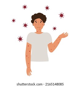 Flat vector illustration of man in t-shirt with blisters on skin caused by ingestion of monkeypox virus isolated on white background