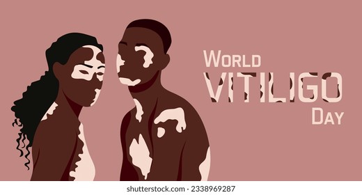 Flat vector illustration, minimalist and modern style. June 25 - World Vitiligo Day. People in a couple (one woman and one man) with Vitiligo skin problems. Positive concept of the fashionable body. 