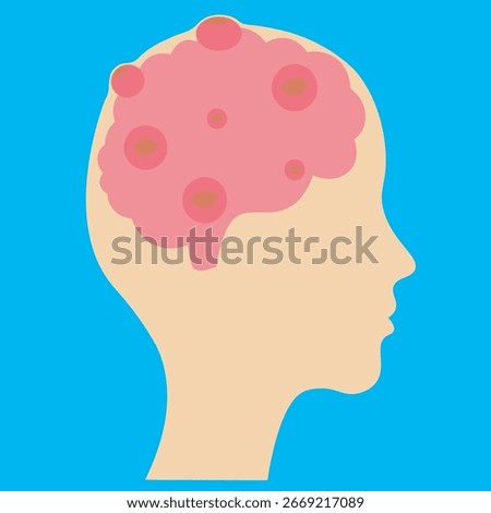 Flat vector illustration silhouette icon of brain tumours showing key symptoms like headaches, vision problems, seizures, and confusion, with similarities to stroke, migraine, and multiple sclerosis.