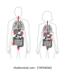 Flat vector isolated illustration of pain and inflammation in adult male and female body. Digestive system anatomy. Liver, stomach, heart and other internal organs icon. Poster for clinic, hospital