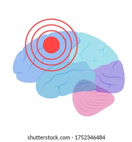 Flat Vector Isolated Illustration Of Pain, Inflammation Or Tumor In Of Human Brain Anatomy. Occipital, Frontal, Parietal And Temporal Lobe. Medical Infographics For Poster. Biological Icon.