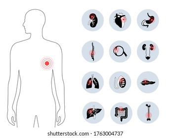 Flat vector isolated illustration of pain and inflammation in adult human body. Digestive system anatomy. Esophagus, stomach, duodenum and other internal organs icon. Medical information poster.