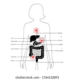 Flat vector isolated illustration of pain and inflammation in adult human body. Digestive system anatomy. Esophagus, stomach, duodenum and other internal organs icon. Medical information poster.