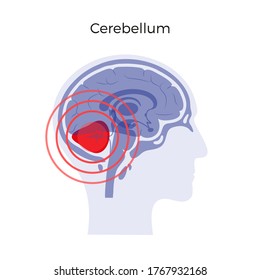 Flat vector isolated illustration of pain, inflammation or tumor in human adult male brain anatomy. Cerebrum icon. Medical infographics for poster.