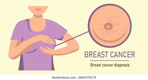 Ilustração médica de vetor plano do diagnóstico de câncer de mama mostrando a área anatômica e a mulher durante o autoexame, conceito de conscientização do cuidado de saúde