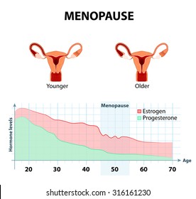 fluctuation of hormones that occurs during menopause. Menopause as a stage in women's lives when their bodies lose the ability to produce enough hormones that keep the body balanced and healthy