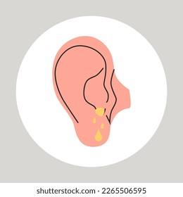 Fluid draining from the ear. Otitis, tinnitus symptom. Bacteria in the middle ear. Flat vector medical illustration.