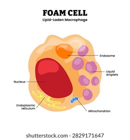 Foam cell anatomy structure diagram infographic, lipid laden macrophage with labeled endosome and lipid droplets, illustrating lipid accumulation and eukaryotic cells cellular atherosclerosis changes.