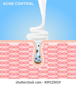 espuma alce creme e loção aplicar sobre a pele e tirar a acne. gráfico vetorial