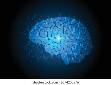 Focal seizure. Abnormal brain waves or EEG arising from one region of brain on blue technology background. 