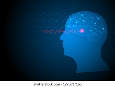 Focal Seizure. Vector Illustration Of Human Brain And Electroencephalograhy Or EEG Originating From Temporal Lobe.