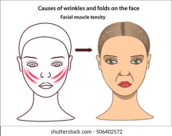 Facial Drooping Vector Concept Caucasian Woman Stock Vector (Royalty ...