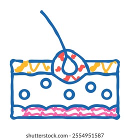 folliculitis skin disease problem doodle icon sketch vector. folliculitis skin disease problem sign. isolated symbol illustration