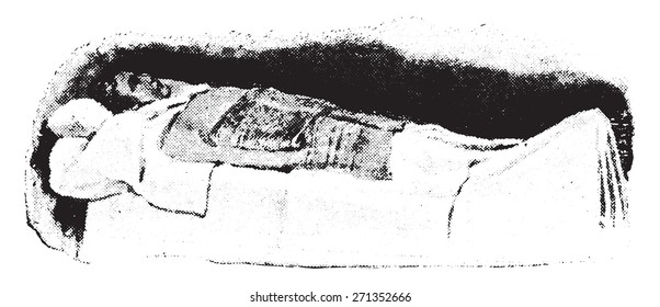 Fomentation, wet cloth folded and in position, vintage engraved illustration. 