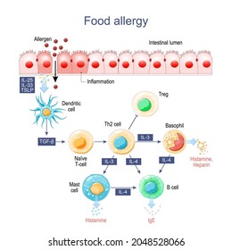 Food Allergy. Inflammation Of Intestine. Allergens, Histamine And Immune Cells, That Release Allergic Reaction.