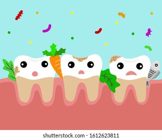  Food Stuck Between Teeth. Unhygiene Dental Concept. Vector Illustration