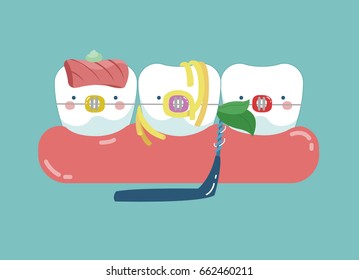 Food stuck teeth, teeth and tooth concept of dental