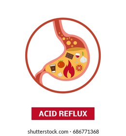 Foods That Causes Acid Reflux Or Heartburn, Vector Concept