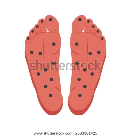Foot Acupuncture flat vector illustration isolated