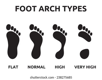 Foot arch types