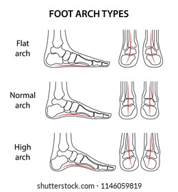 Foot Arch Types Set Black Foots Stock Vector (Royalty Free) 1146059819 ...