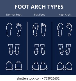 Foot arch types vector icon set. Set of flat foot, high arch