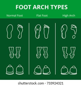 Foot arch types vector icons. Set of flat foot, high arch