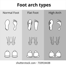 Foot arch types vector icons. Set of flat foot, high arch