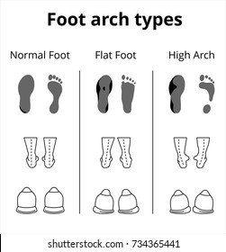 Foot arch types vector icons. Set of flat foot, high arch