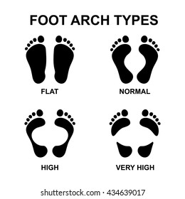 Foot arch types vector infographics. Set of flat foot, high arch