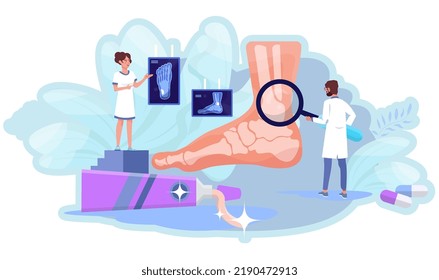 Foot arthritis concept. Doctor is examining patient's foot. X-ray scan. Orthopedist appointment. Joint disease, ankle arthritis. Dosctor examines foot with a giant magnifier. Tiny doctors.