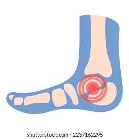 Foot articulation icon cartoon vector. Medical patient. Arthritis joint