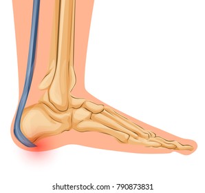 Foot Bone Anatomy Vector Illustration Medical art