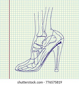 Foot bones of woman wearing high heels. Hand drawn vector illustration
