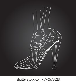 Foot bones of woman wearing high heels. Hand drawn vector illustration