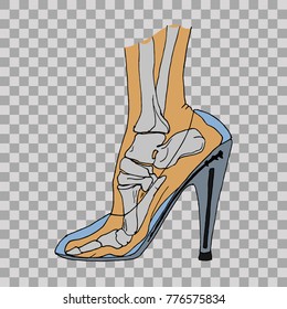 Foot bones of woman wearing high heels. Hand drawn vector illustration
