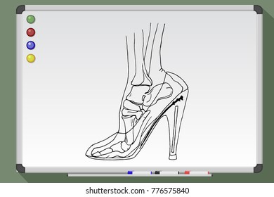 Foot bones of woman wearing high heels. Hand drawn vector illustration