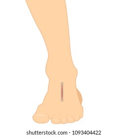 Foot cartoon vector. suture cartoon vector. free space for text. wallpaper. background.