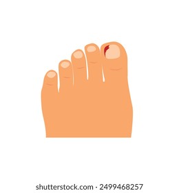 Vector de dibujos animados del pie. Vector del dedo del pie. Fondo de pantalla. espacio libre para texto. espacio de copia. Desgarra las uñas.