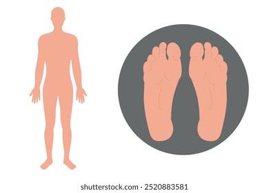 Foot deformation disease in human. Orthopedist  infographic and diagram