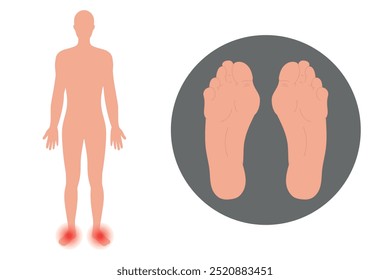 Foot deformation in human. Orthopedist  infographic and diagram