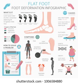 Foot deformation as medical desease infographic. Causes of Flat foot. Vector illustration