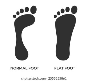 Foot deformation. Normal and flat foot prints. Medical or orthopedic theme infographic. Vector illustration in flat style isolated on white background.