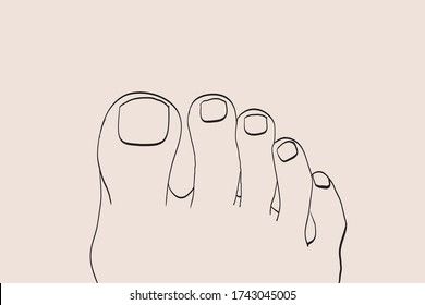 foot drawn with podiatry problems. Fingers and nails to be restored for the podiatrist
