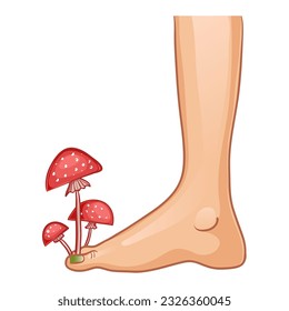 Foot with fungal infection, concept illustration with growing mushrooms, vector image, eps10